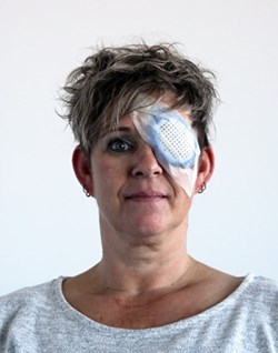 Staaroperatie_verband1