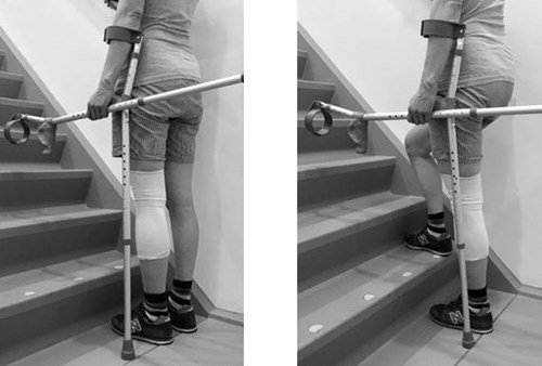 Fysiotherapie na een knieoperatie - trap omhoog