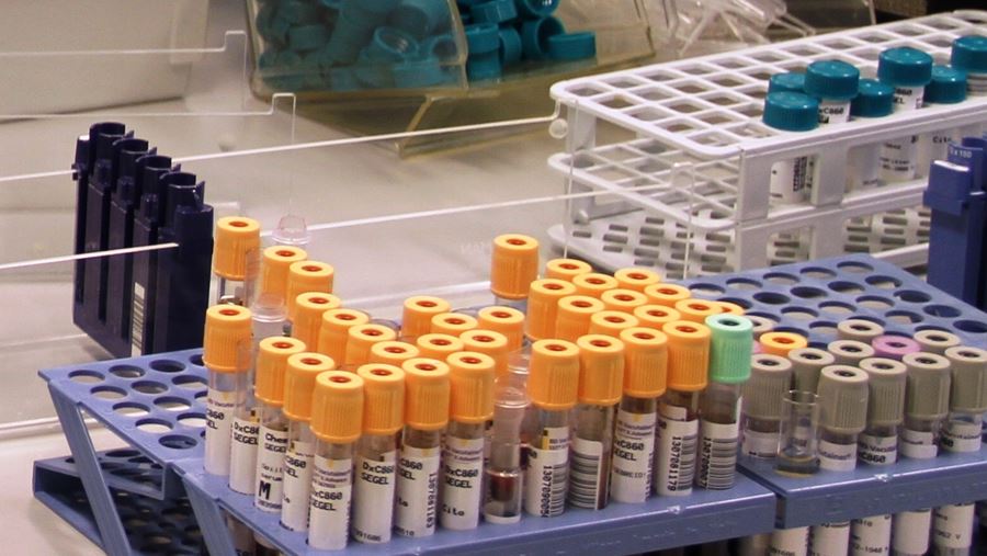 Laboratorium Bloedafnamebuisjes Laboratorium Bloedafnamebuisjes
