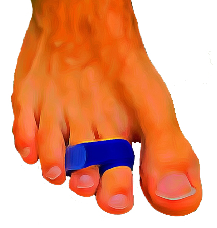 Gebroken teen aan een naastliggende teen vastmaken.