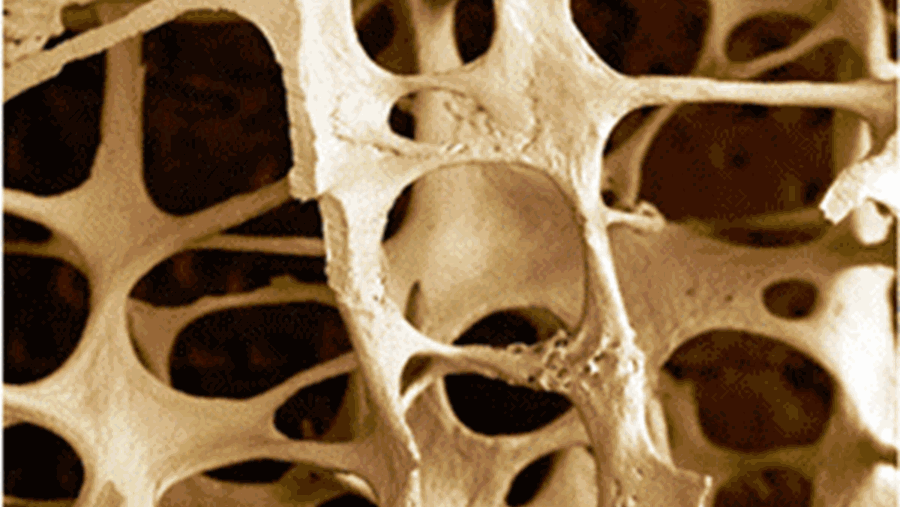 Afbeelding binnenkant bot Afbeelding binnenkant bot