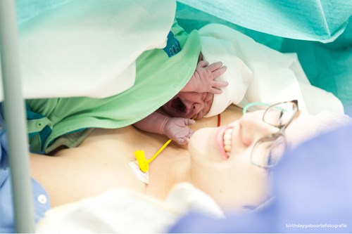 Pasgeboren baby bij moeder op de buik na keizersnede