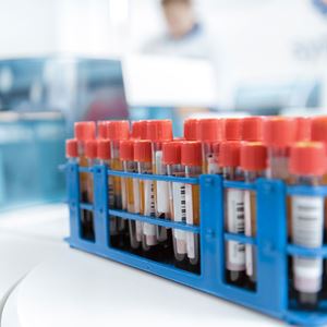 Bloedbuisjes Uitgelicht afbeelding