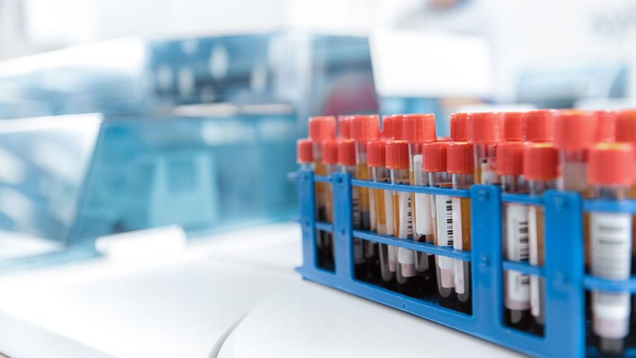 Bloedbuisjes Bloedbuisjes