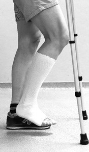 Als je niet op het geopereerde been mag steunen (onbelast ‘lopen’)1